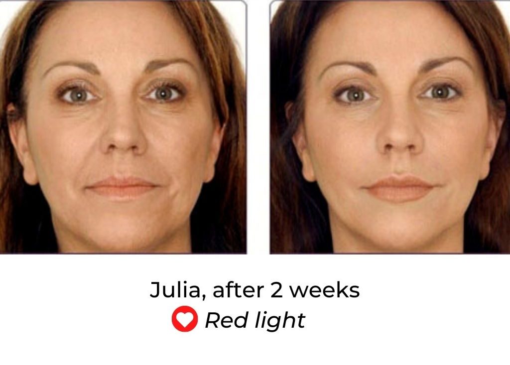 LED Face Mask Before and After